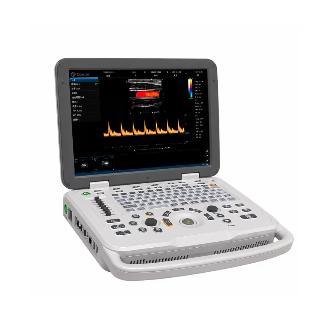 ortable Color Doppler Ultrasound (3)