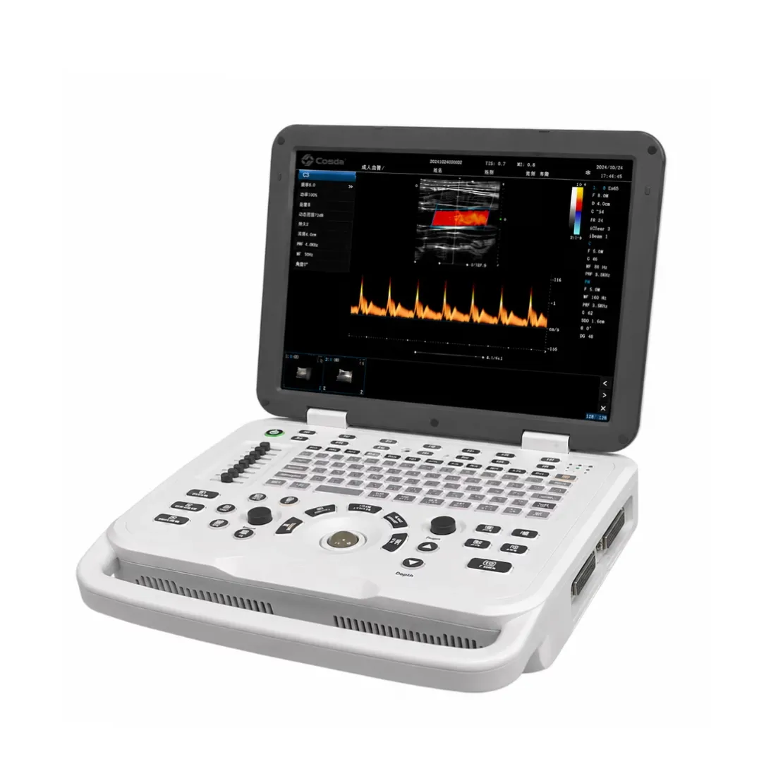 ortable Color Doppler Ultrasound (1)